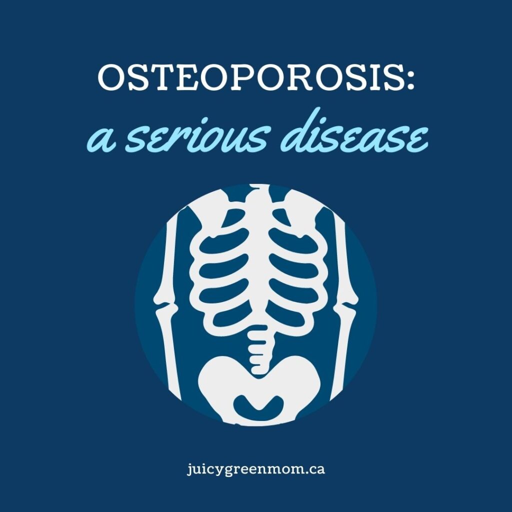 OSTEOPOROSIS a serious disease juicygreenmom